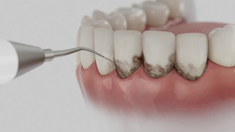 Trusted Teeth Cleaning And Checkup service in Newberry, MI - Dentist Open Now